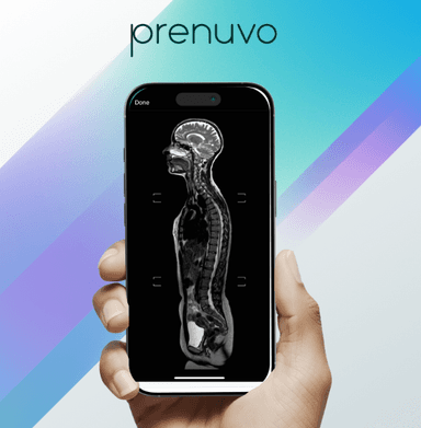 Product image for Whole Body Scan