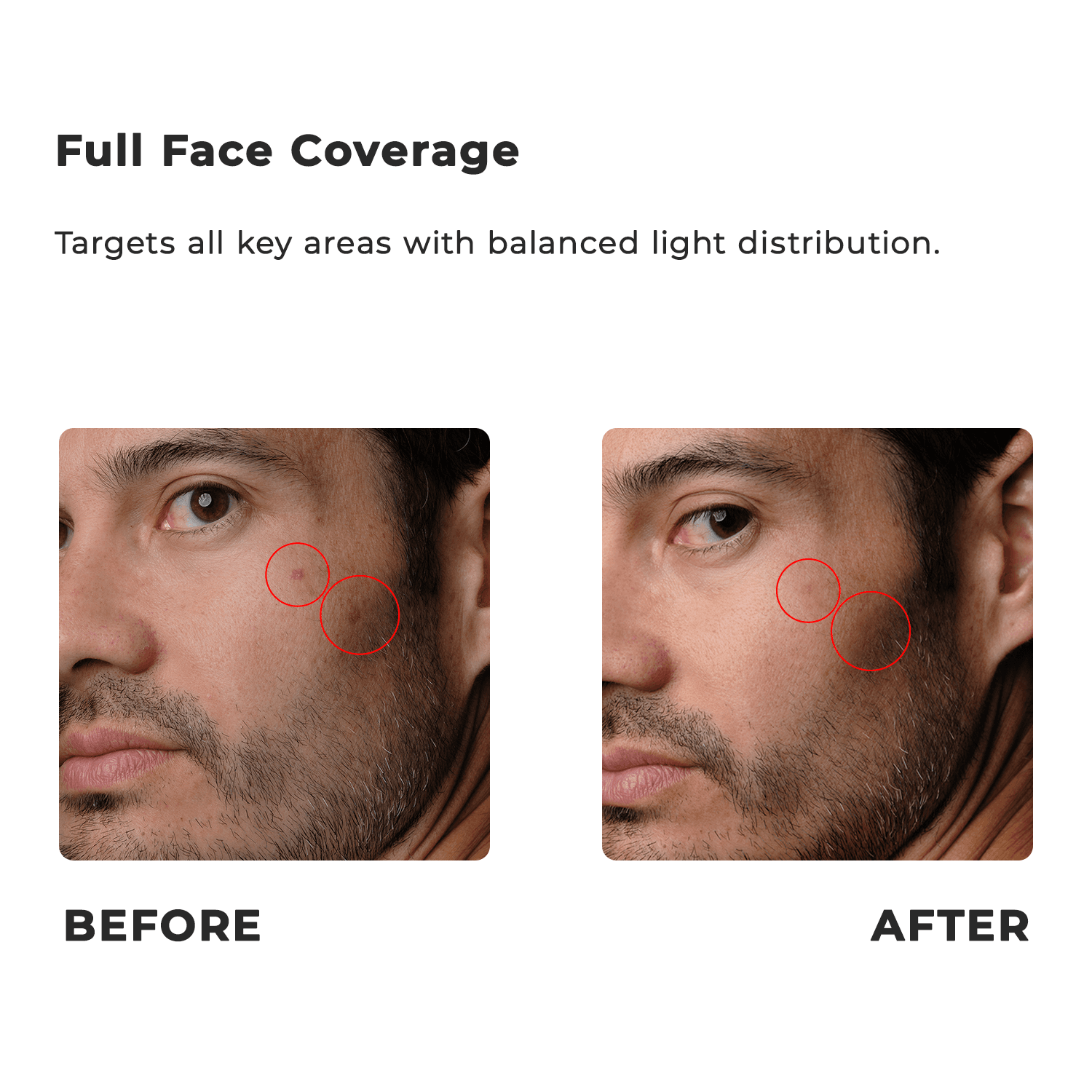 Capillus Face Mask Black - view 2