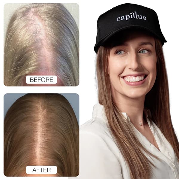 Capillus PRO - view 4