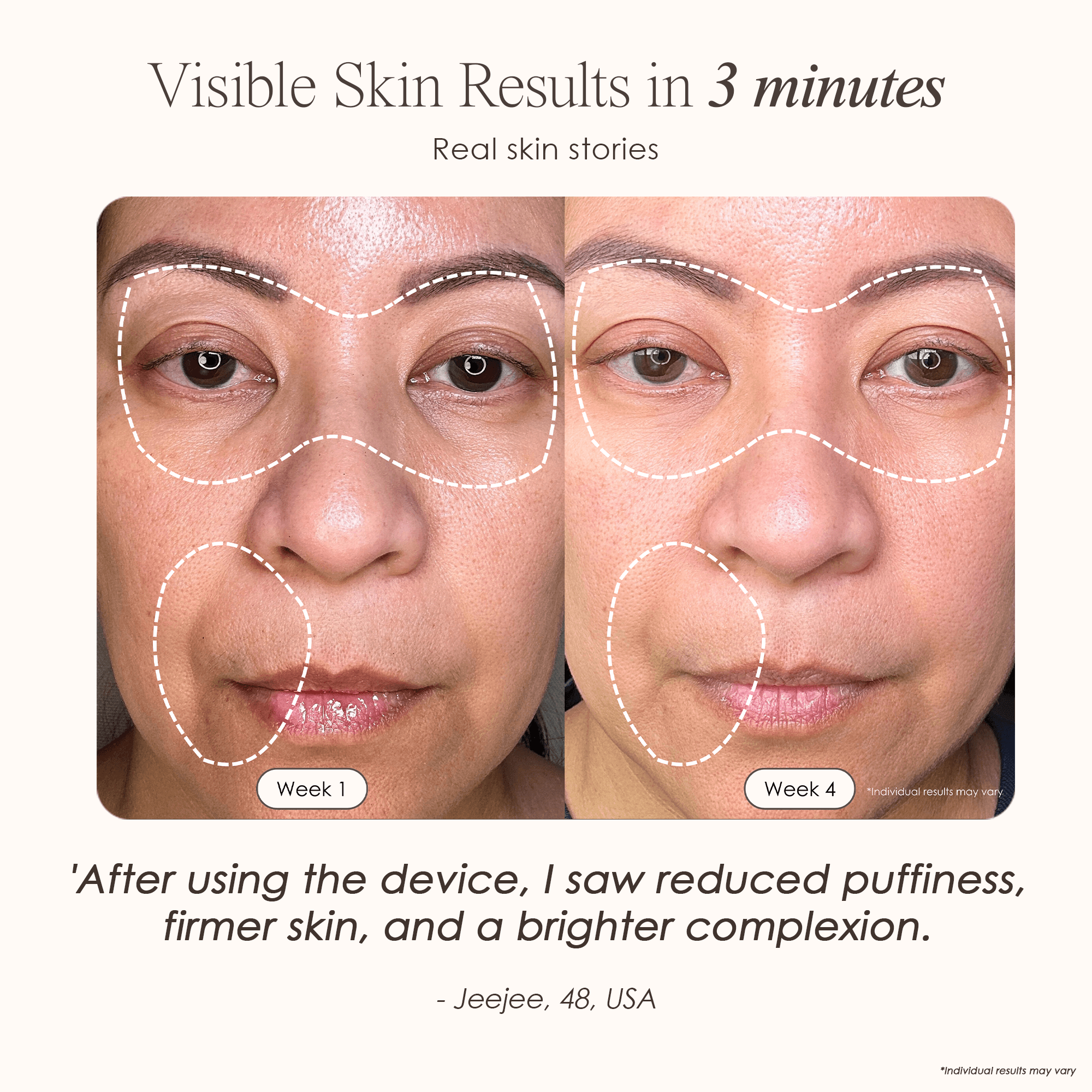 LumaLux Face+ Pro LED Red Light Therapy Face & Neck Mask - view 2