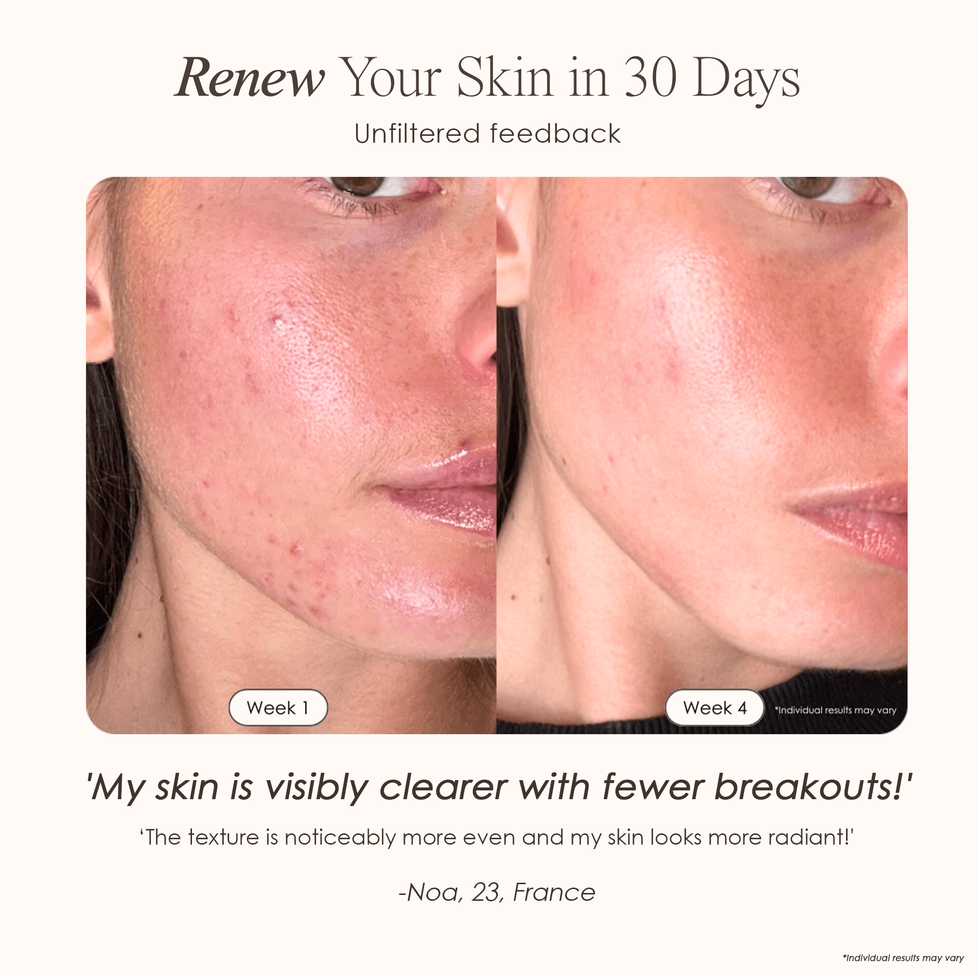 LumaLux Face+ Pro LED Red Light Therapy Face & Neck Mask - view 3