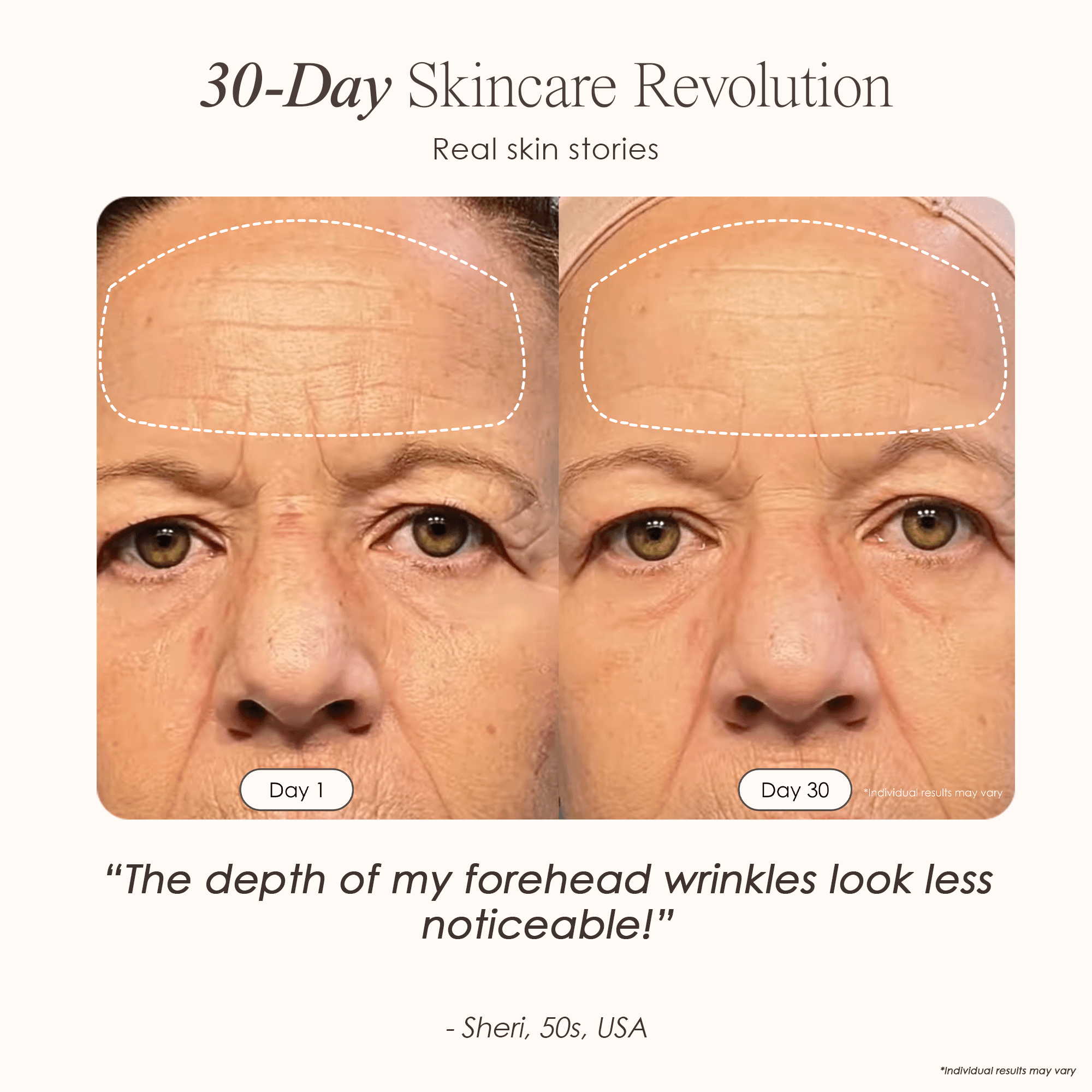 LumaLux Face Pro LED Red Light Therapy Mask - view 3