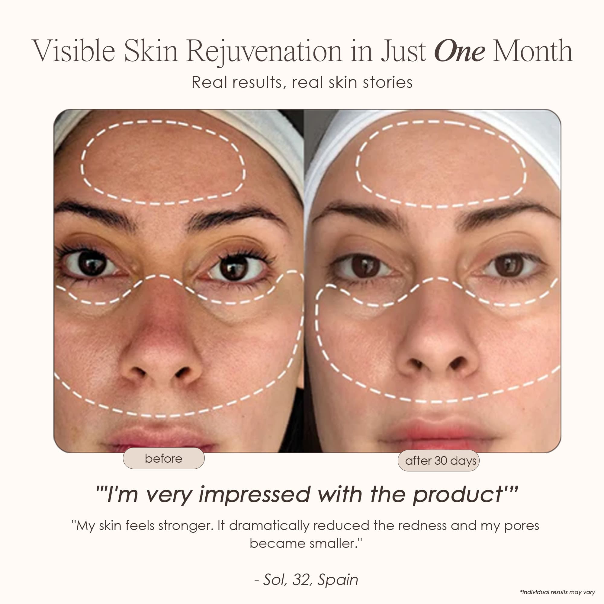 Lumamask Pro LED Red Light Therapy Face Mask - view 3