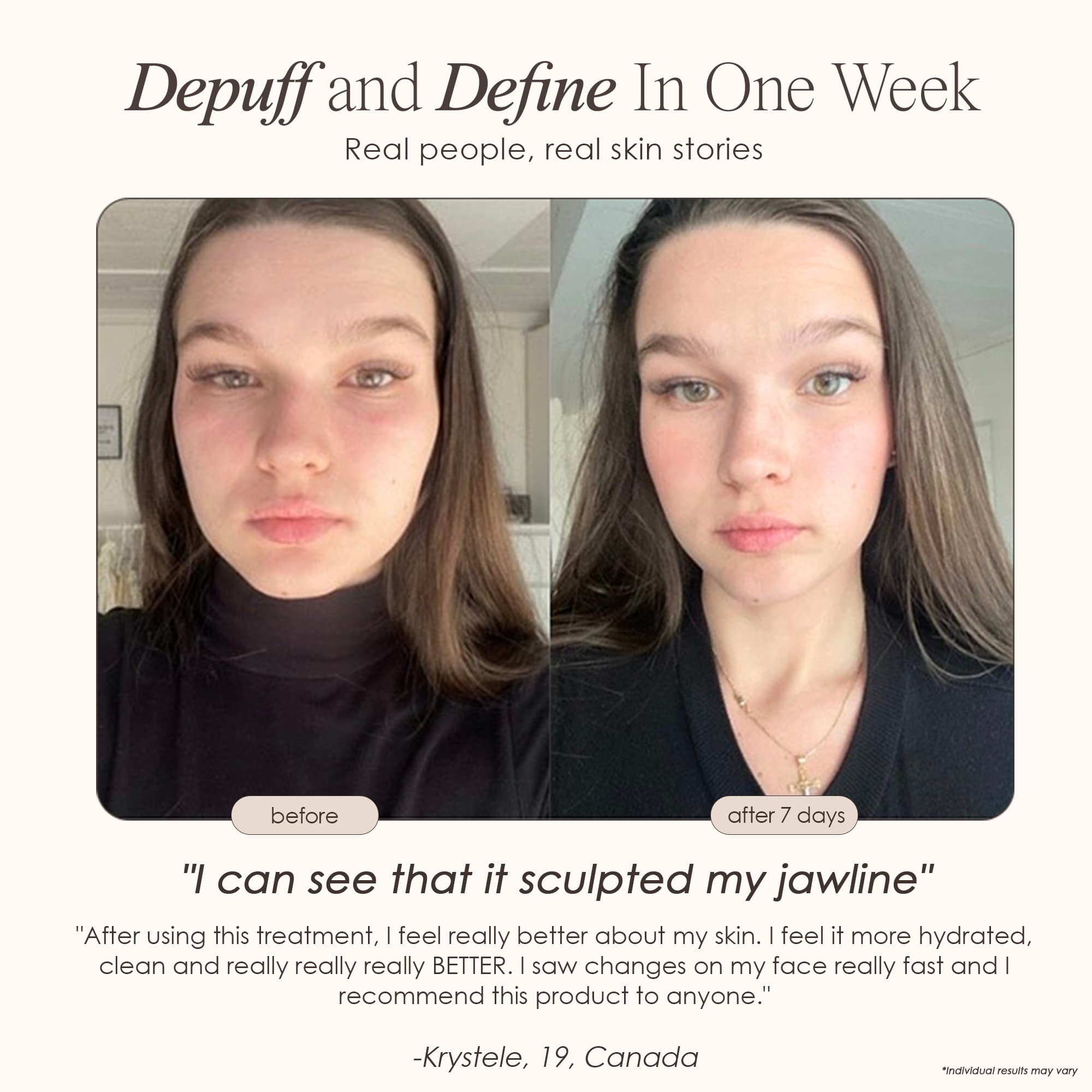 The Ice Roller Cryotherapy Treatment - view 5