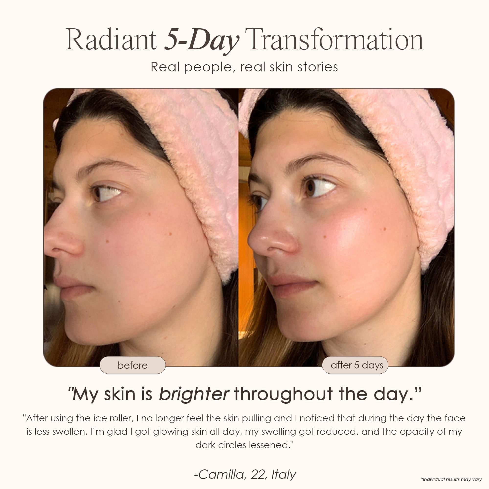 The Ice Roller Cryotherapy Treatment - view 4