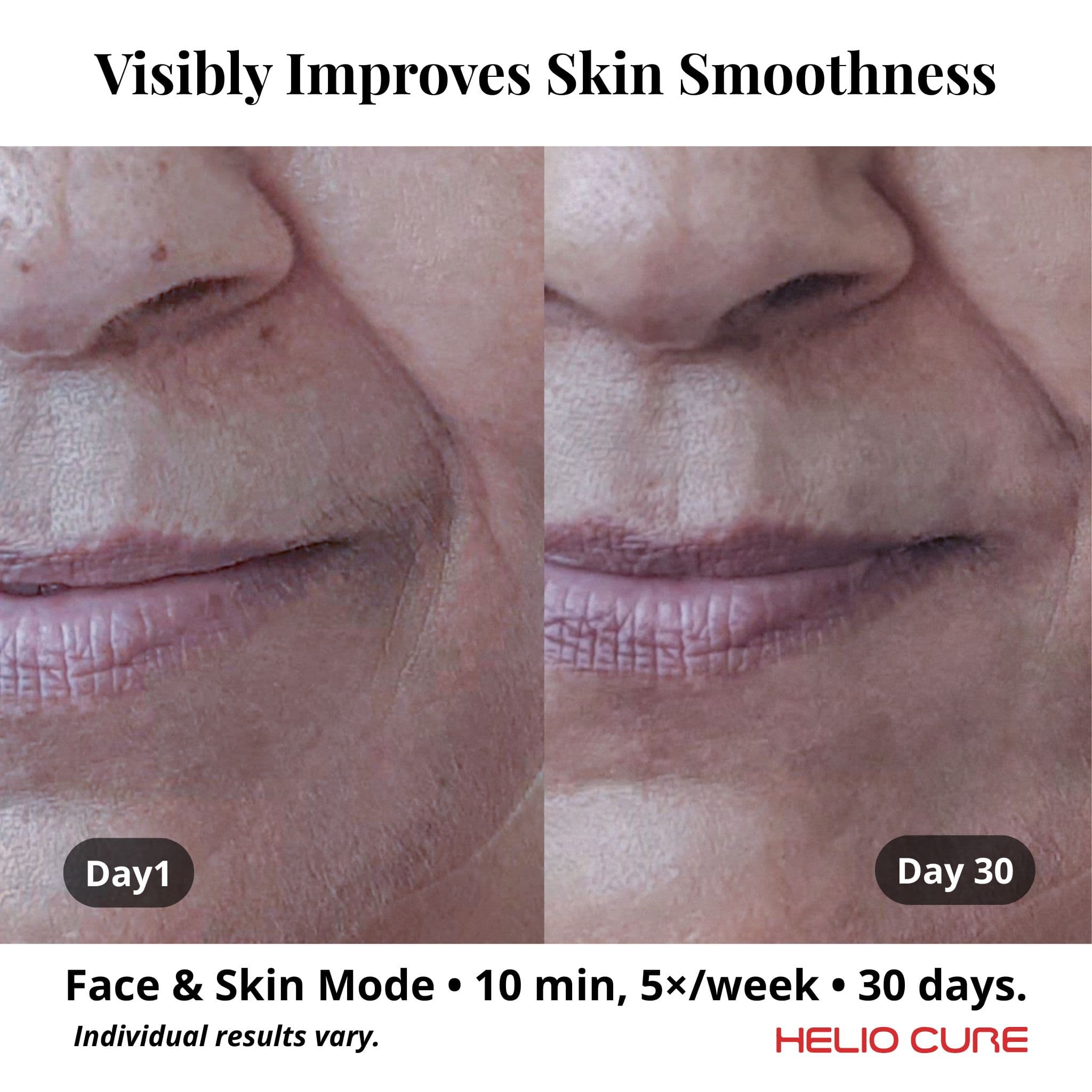 Helio Blaze - view 5