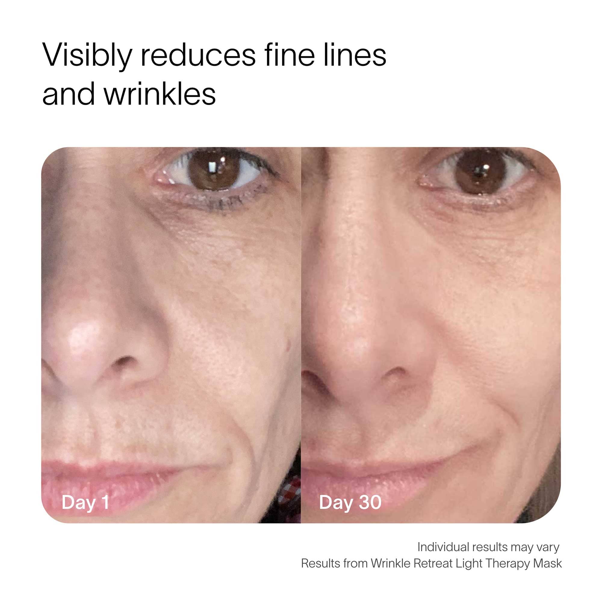 Wrinkle Retreat Red Light Therapy Face Mask - view 4